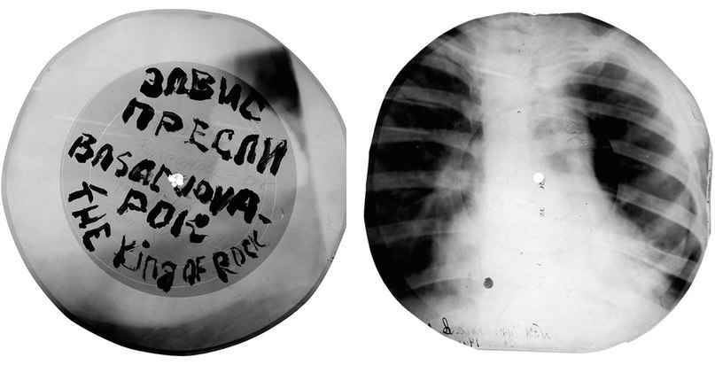 Пластинка с записями Элвиса Пресли изготовленная из рентгеновского снимка грудной клетки